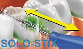Anwendung von Solo-Stix® zwischen den Zähnen